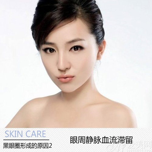 黑眼圈是怎么形成的?揪出成因重现明眸-去黑眼